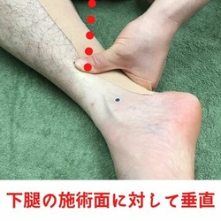 下腿の施術