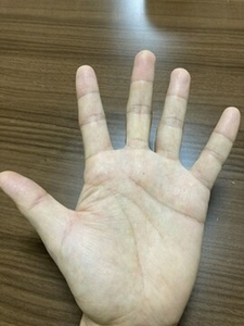手のひら