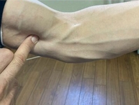 手の三陰経（上腕編）